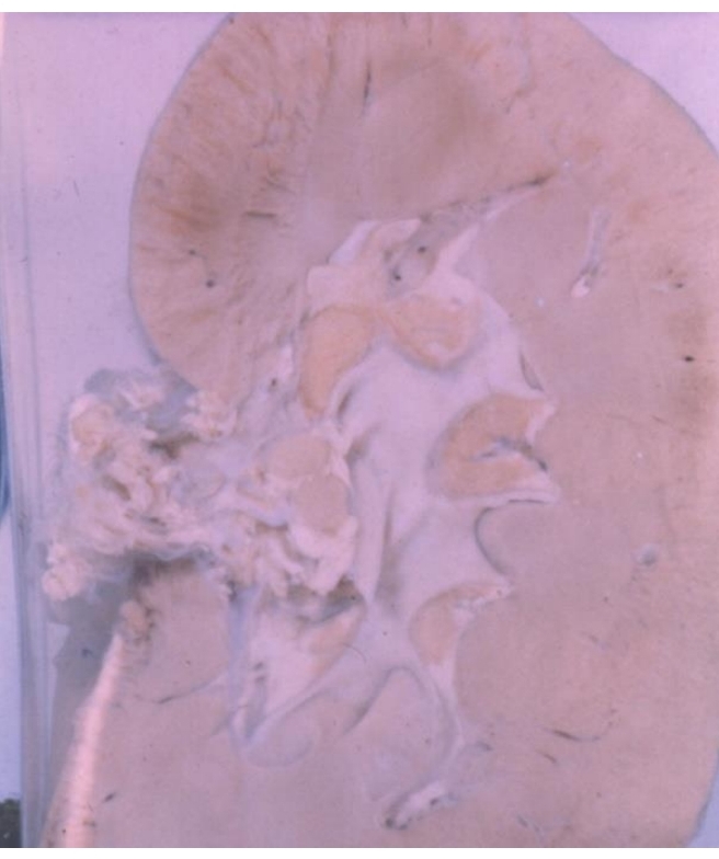 Pathology Slide